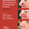 Reconstructive Conundrums in Dermatologic Surgery: The Nose 1st Edition