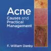 Acne: Causes and Practical Management 1st Edition