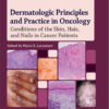 Dermatologic Principles and Practice in Oncology: Conditions of the Skin, Hair, and Nails in Cancer Patients 1st Edition