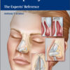 Rhinoplasty: The Experts' Reference 1st Edition