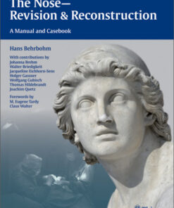The Nose - Revision and Reconstruction: A Manual and Casebook 1st edition