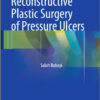Reconstructive Plastic Surgery of Pressure Ulcers 2015th Edition