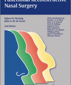 Functional Reconstructive Nasal Surgery 2nd Edition
