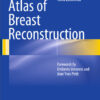 Atlas of Breast Reconstruction 2015th Edition