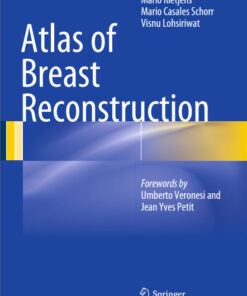 Atlas of Breast Reconstruction 2015th Edition