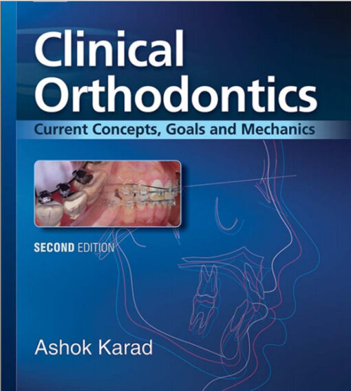 Ebook Clinical Orthodontics: Current Concepts, Goals and Mechanics 2nd Edition