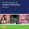 Ebook  Fundamentals of Implant Dentistry 1st Edition