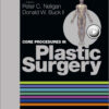 Core Procedures in Plastic Surgery, 1e