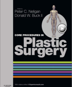 Core Procedures in Plastic Surgery, 1e