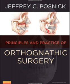 Orthognathic Surgery - 2 Volume Set: Principles and Practice, 1e