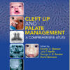 Ebook  Cleft Lip and Palate Management: A Comprehensive Atlas 1st Edition