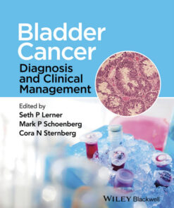 Bladder Cancer: Diagnosis and Clinical Management 1st Edition