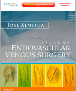 Atlas of Endovascular Venous Surgery Video & Ebooks