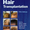 Ebook Hair Transplantation, Fifth Edition