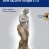Encyclopedia of Body Sculpting After Massive Weight Loss 1st  Edition