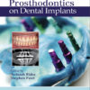 Ebook Journal of Prosthodontics on Dental Implants 1st Edition