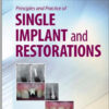 Ebook Principles and Practice of Single Implant and Restoration, 1e 1st Edition