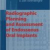 Ebook Radiographic Planning and Assessment of Endosseous Oral Implants