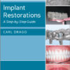 Ebook Implant Restorations: A Step-by-Step Guide 3rd Edition