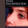 Nasal Reconstruction: Art and Practice, 1e