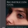 Reconstrucción nasal: Arte y práctica (Spanish Edition)