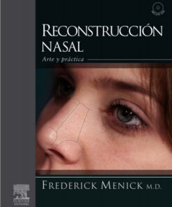 Reconstrucción nasal: Arte y práctica (Spanish Edition)