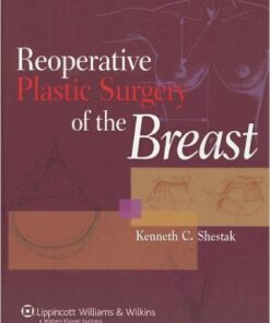 Reoperative Plastic Surgery of the Breast 1st Edition