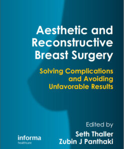 Aesthetic and Reconstructive Breast Surgery: Solving Complications and Avoiding Unfavorable Results 1st