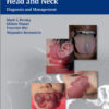 Vascular Lesions of the Head and Neck: Diagnosis and Management 1st edition