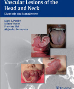 Vascular Lesions of the Head and Neck: Diagnosis and Management 1st edition