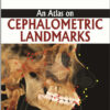 An Atlas on Cephalometric Landmarks 1st Edition