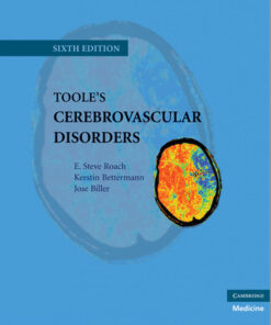 Toole's Cerebrovascular Disorders (Cambridge Medicine) 6th Edition