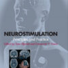 Neurostimulation: Principles and Practice 1st Edition