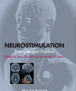 Neurostimulation: Principles and Practice 1st Edition