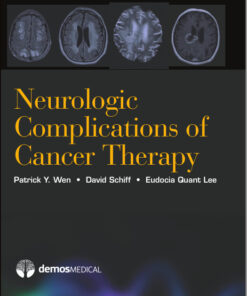 Neurologic Complications of Cancer Therapy 1st Edition