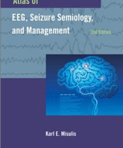 Atlas of EEG, Seizure Semiology, and Management 2nd Edition