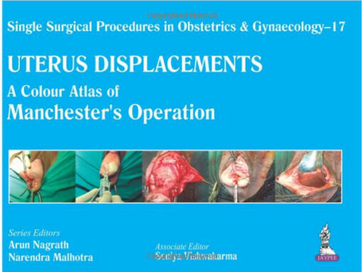 Uterus Displacements: A Colour Atlas of Manchester's Operation 1st Edition