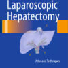 Laparoscopic Hepatectomy: Atlas and Techniques 2015th Edition
