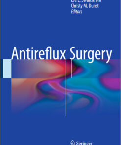 Antireflux Surgery 2015th Edition