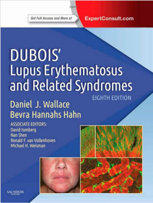 Dubois' Lupus Erythematosus and Related Syndromes: Expert Consult - Online and Print, 8e 8th Edition