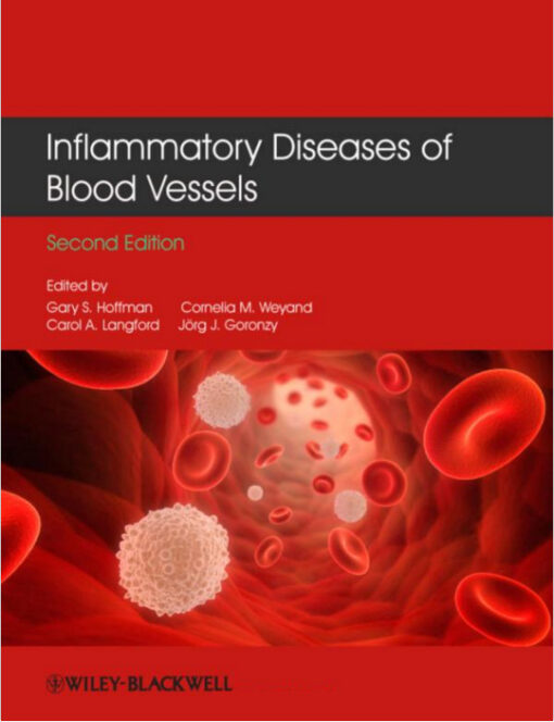 Inflammatory Diseases of Blood Vessels 2nd Edition