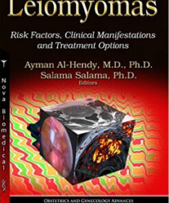 Leiomyomas: Risk Factors, Clinical Manifestations and Treatment Options