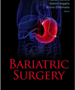 Bariatric Surgery