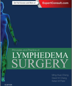 Principles and Practice of Lymphedema Surgery, 1e