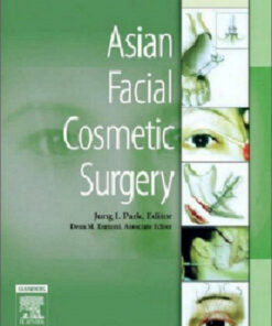 Asian Facial Cosmetic Surgery, 1e 1st Edition