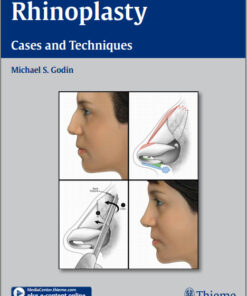 DVD Videos + Ebooks Rhinoplasty - Cases and Techniques 1st edition