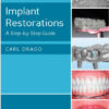 Implant and Regenerative Therapy in Dentistry: A Guide to Decision Making 1st Edition