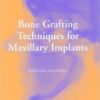 Bone Grafting Techniques for Maxillary Implants 1st Edition