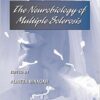 The Neurobiology of Multiple Sclerosis, Volume 79 (International Review of Neurobiology) 1st Edition