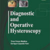 Diagnostic and Operative Hysteroscopy 2nd (second) Revised Edition